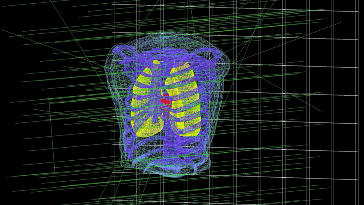 Geant4 Framework for X-Ray Radiography & CT Simulation